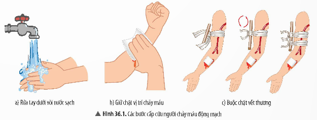 1. CHUẨN BỊ- Dụng cụ: băng y tế, gạc y tế, bông y tế, miếng dán vết thương, dây garo, máy đo huyết áp. - Hoá chất: xà phòng rửa tay, dung dịch sát trùng (iodine, nước muối sinh lí, oxy già (hydrogen peroxide)).2. CÁCH TIẾN HÀNH