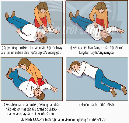 1. HÔ HẤP NHÂN TẠO, CẤP CỨU NGƯỜI ĐUỐI NƯỚC- Dụng cụ: chiếu cá nhân hoặc thảm trải sàn kích thước đủ để người giả định nằm, gối cá nhân, gạc y tế hoặc mảnh vải có kích thước khoảng 40 × 40 mm, hình nộm người duối nước hoặc mô hình người. - Tiến hành: Có hai phương pháp hô hấp nhân tạo thường được dùng trong cấp cứu người đuối nước: - Phương pháp hà hơi thổi ngạt + Bước 1: Nhanh chóng đưa nạn nhân ra khỏi mặt nước, đặt nạn nhân nằm ngửa nơi khô ráo, đầu ngửa ra phía sau, nâng cằm lên trên. + Bước 2: Dùng hai ngón tay kẹp mũi nạn nhân. Nếu miệng nạn nhân bị cứng, khó mở thì có thể dùng tay bịt miệng và thối vào mũi. Nếu lưỡi nạn nhân bị thụt vào, người cấp cứu dùng gạc hoặc vải cuộn vào tay để kéo ra. + Bước 3: Tự hít một hơi đầy lồng ngực rồi ghé sát môi vào miệng nạn nhân (hoặc sát mũi nếu miệng bị cứng) và thổi hết sức vào phối nạn nhân, không để không khí lọt ra ngoài chỗ tiếp xúc với miệng. Ngừng thở để hít vào rồi lại thổi liên tục từ 15 – 20 lần/phút cho đến khi nạn nhân có dấu hiệu thở lại.- Phương pháp ép tim ngoài lồng ngực: Để người bệnh nằm lên một mặt phẳng cứng, quỳ gối phía bên trái của người bệnh. Chồng hai bàn tay lên và đặt trước tim (ngay trên xương ức), dùng toàn lực ép mạnh và sâu xuống 1/3 lồng ngực rồi nới lỏng tay. Lặp lại động tác này liên tục 60 lần/phút để tăng co bóp tim. Luyện tập: Thảo luận với bạn trong nhóm và thực hiện các yêu cầu sau: a) Nêu ý nghĩa của việc kẹp mũi nạn nhân trong phương pháp hà hơi thôi ngạt. b) Cho biết mục đích của việc thực hiện ép tim ngoài lồng ngực.Giải chi tiết:a) Việc kẹp mũi nạn nhân trong phương pháp hà hơi thổi ngạt giúp ngăn không khí thoát ra ngoài qua mũi, đảm bảo không khí thổi vào miệng nạn nhân được giữ lại trong phổi. Điều này giúp tăng hiệu quả của việc cung cấp oxy cho nạn nhân, đồng thời tránh làm cho không khí thổi ra ngoài, giúp duy trì hô hấp cho người bị ngừng thở cho đến khi có sự hỗ trợ y tế.b) Mục đích của việc thực hiện ép tim ngoài lồng ngực: giúp duy trì sự lưu thông máu đến các cơ quan quan trọng, đặc biệt là não và tim, khi tim ngừng đập hoặc ngừng co bóp. Việc ép tim tạo ra áp lực lên ngực, giúp bơm máu ra khỏi tim và đảm bảo cung cấp oxy cho cơ thể, từ đó mua thời gian cho việc cấp cứu y tế và phục hồi chức năng tim. 2. CẤP CỨU NGƯỜI BỊ ĐỘT QUỴ NÃO