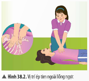 1. HÔ HẤP NHÂN TẠO, CẤP CỨU NGƯỜI ĐUỐI NƯỚC- Dụng cụ: chiếu cá nhân hoặc thảm trải sàn kích thước đủ để người giả định nằm, gối cá nhân, gạc y tế hoặc mảnh vải có kích thước khoảng 40 × 40 mm, hình nộm người duối nước hoặc mô hình người. - Tiến hành: Có hai phương pháp hô hấp nhân tạo thường được dùng trong cấp cứu người đuối nước: - Phương pháp hà hơi thổi ngạt + Bước 1: Nhanh chóng đưa nạn nhân ra khỏi mặt nước, đặt nạn nhân nằm ngửa nơi khô ráo, đầu ngửa ra phía sau, nâng cằm lên trên. + Bước 2: Dùng hai ngón tay kẹp mũi nạn nhân. Nếu miệng nạn nhân bị cứng, khó mở thì có thể dùng tay bịt miệng và thối vào mũi. Nếu lưỡi nạn nhân bị thụt vào, người cấp cứu dùng gạc hoặc vải cuộn vào tay để kéo ra. + Bước 3: Tự hít một hơi đầy lồng ngực rồi ghé sát môi vào miệng nạn nhân (hoặc sát mũi nếu miệng bị cứng) và thổi hết sức vào phối nạn nhân, không để không khí lọt ra ngoài chỗ tiếp xúc với miệng. Ngừng thở để hít vào rồi lại thổi liên tục từ 15 – 20 lần/phút cho đến khi nạn nhân có dấu hiệu thở lại.- Phương pháp ép tim ngoài lồng ngực: Để người bệnh nằm lên một mặt phẳng cứng, quỳ gối phía bên trái của người bệnh. Chồng hai bàn tay lên và đặt trước tim (ngay trên xương ức), dùng toàn lực ép mạnh và sâu xuống 1/3 lồng ngực rồi nới lỏng tay. Lặp lại động tác này liên tục 60 lần/phút để tăng co bóp tim. Luyện tập: Thảo luận với bạn trong nhóm và thực hiện các yêu cầu sau: a) Nêu ý nghĩa của việc kẹp mũi nạn nhân trong phương pháp hà hơi thôi ngạt. b) Cho biết mục đích của việc thực hiện ép tim ngoài lồng ngực.Giải chi tiết:a) Việc kẹp mũi nạn nhân trong phương pháp hà hơi thổi ngạt giúp ngăn không khí thoát ra ngoài qua mũi, đảm bảo không khí thổi vào miệng nạn nhân được giữ lại trong phổi. Điều này giúp tăng hiệu quả của việc cung cấp oxy cho nạn nhân, đồng thời tránh làm cho không khí thổi ra ngoài, giúp duy trì hô hấp cho người bị ngừng thở cho đến khi có sự hỗ trợ y tế.b) Mục đích của việc thực hiện ép tim ngoài lồng ngực: giúp duy trì sự lưu thông máu đến các cơ quan quan trọng, đặc biệt là não và tim, khi tim ngừng đập hoặc ngừng co bóp. Việc ép tim tạo ra áp lực lên ngực, giúp bơm máu ra khỏi tim và đảm bảo cung cấp oxy cho cơ thể, từ đó mua thời gian cho việc cấp cứu y tế và phục hồi chức năng tim. 2. CẤP CỨU NGƯỜI BỊ ĐỘT QUỴ NÃO