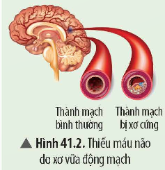 Tech12h
