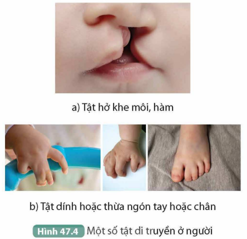 I. TÍNH TRẠNG Ở NGƯỜI