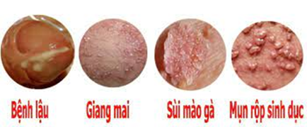 I. ĐẶC ĐIỂM VÀ CÁC GIAI ĐOẠN SINH TRƯỞNG, PHÁT TRIỂN