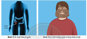 KHÁI NIỆM, VAI TRÒ CỦA DI TRUYỀN HỌC NGƯỜI VÀ DI TRUYỀN Y HỌC