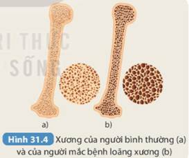 BÀI 31. HỆ VẬN ĐỘNG Ở NGƯỜI (22 câu)
