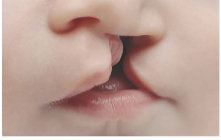 I. MỤC TIÊU